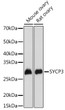 Western blot analysis of various lysates using SYCP3 Rabbit pAb (STJ111740) at 1:1000 dilution. <br/>Secondary antibody: HRP-conjugated Goat anti-Rabbit IgG (H+L) (STJS000856) at 1:10000 dilution. <br/>Lysates/proteins: 25 Mu g per lane. <br/>Blocking buffer: 3% nonfat dry milk in TBST. <br/>Detection: ECL Basic Kit <br/>Exposure time: 30s.