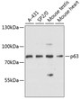 Western blot analysis of various lysates using p63 Rabbit polyclonal antibody (STJ114803) at 1:3000 dilution. Secondary antibody: HRP Goat Anti-Rabbit IgG (H+L) (STJS000856) at 1:10000 dilution. Lysates/proteins: 25 Mu g per lane. Blocking buffer: 3% nonfat dry milk in TBST. Detection: ECL Basic Kit. Exposure time: 10s.