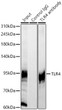 Immunoprecipitation analysis of 300ug extracts of HeLa cells using 3ug TLR4 Rabbit polyclonal antibody (STJ113740 1:100). Western blot was performed from the immunoprecipitate using TLR4 Rabbit polyclonal antibody antibody (STJ113740) at a dilition of 1:500.