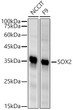 Western blot analysis of extracts of various cell lines, using SOX2 antibody (STJ113816) at 1:500 dilution. Secondary antibody: HRP Goat Anti-rabbit IgG (H+L) (STJS000856) at 1:10000 dilution. Lysates/proteins: 25 Mu g per lane. Blocking buffer: 3% non-fat dry milk in TBST. Detection: ECL Basic Kit. Exposure time: 30s.