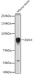 Western blot analysis of extracts of mouse testis, using DDX4 antibody (STJ118072) at 1:1000 dilution. Secondary antibody: HRP Goat Anti-rabbit IgG (H+L) (STJS000856) at 1:10000 dilution. Lysates/proteins: 25 Mu g per lane. Blocking buffer: 3% non-fat dry milk in TBST. Detection: ECL Basic Kit. Exposure time: 10s.