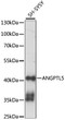 Western blot analysis of lysates from SH-SY5Y cells, using ANGPTL5 Rabbit polyclonal antibody (STJ117415) at 1:1000 dilution. Secondary antibody: HRP Goat Anti-Rabbit IgG (H+L) (STJS000856) at 1:10000 dilution. Lysates/proteins: 25 Mu g per lane. Blocking buffer: 3% nonfat dry milk in TBST. Detection: ECL Basic Kit. Exposure time: 60S.