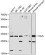 Western blot analysis of extracts of various cell lines, using DAZL antibody (STJ23340) at 1:1000 dilution. Secondary antibody: HRP Goat Anti-Rabbit IgG (H+L) (STJS000856) at 1:10000 dilution. Lysates/proteins: 25 Mu g per lane. Blocking buffer: 3% nonfat dry milk in TBST. Detection: ECL Basic Kit. Exposure time: 30s.