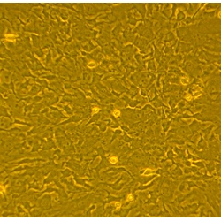 C57BL/6 Mouse Bone Marrow Mesenchymal Stem Cells (B6MSC) C57BL/6 Mouse Bone Marrow Mesenchymal Stem Cells (B6MSC)
