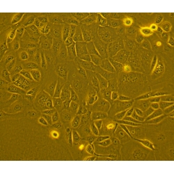 Human Primary Colonic Epithelial Cells Human Primary Colonic Epithelial Cells