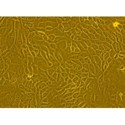 Human Primary Corneal Epithelial Cells Human Primary Corneal Epithelial Cells