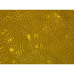 Human Primary Esophageal Epithelial Cells Human Primary Esophageal Epithelial Cells
