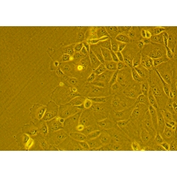 Human Primary Stomach Epithelial Cells Human Primary Stomach Epithelial Cells