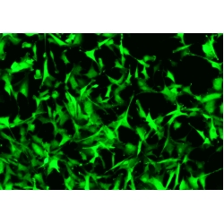 Human Primary Mammary Fibroblasts Human Primary Mammary Fibroblasts