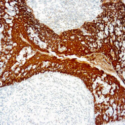 Formalin fixed paraffin embedded human tonsil stained with Cytokeratin 5/14 labeled with Stable DAB/Plus (K047).