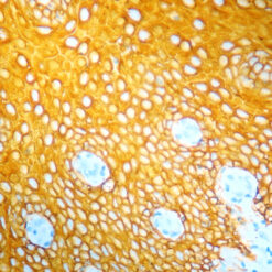 Formalin fixed paraffin embedded human tonsil stained with Cytokeratin H.M.W labeled with PermaYellow/HRP(K 060).
