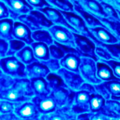 Formalin fixed paraffin embedded human tonsil stained with HMW CK antibody (PDM074) labeled with PermaBlue Plus/AP Chromogen (K058) produces a distinct bright blue color.