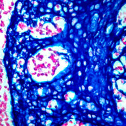 Formalin fixed paraffin embedded human tonsil stained with Cytokeratin H.M.W and labeled with PermaBlue/HRP(K063).