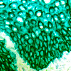 Formalin fixed paraffin embedded human tonsil stained with HMW CK antibody (PDM074) labeled with PermaGreen Plus/AP Chromogen (K059) produces a strong green color.