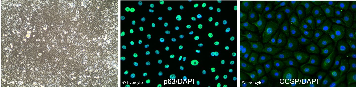HBEC3-KT Morphology