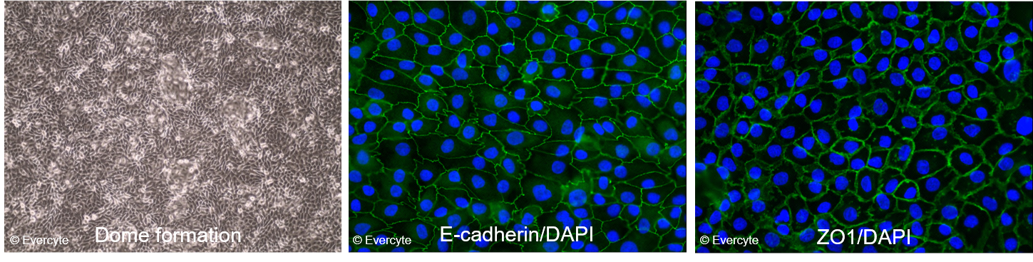 Morphology and expression of marker proteins