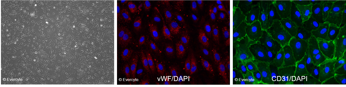 Morphology and marker expression_HUVEC_TERT66