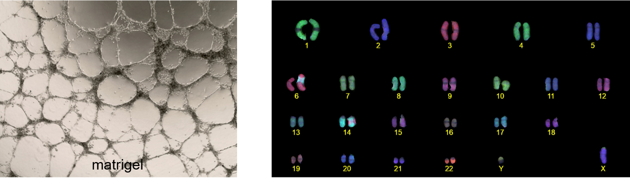 Neo-angiogenic potential and karyotype analysis_HUVEC_TERT66