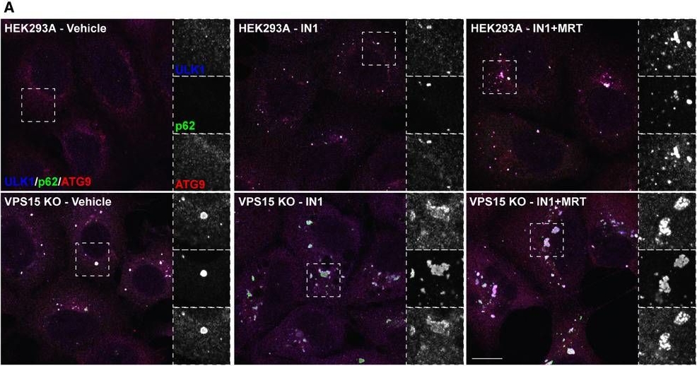 Phosphoproteomic identification of ULK substrates reveals VPS15-dependent ULK/VPS34 interplay in the regulation of autophagy.