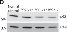 Ribosomal protein mutations induce autophagy through S6 kinase inhibition of the insulin pathway.