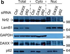 Cytoplasmic DAXX drives SQSTM1/p62 phase condensation to activate Nrf2-mediated stress response.