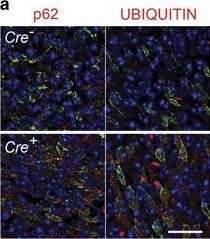 TSC but not PTEN loss in starving cones of retinitis pigmentosa mice leads to an autophagy defect and mTORC1 dissociation from the lysosome.