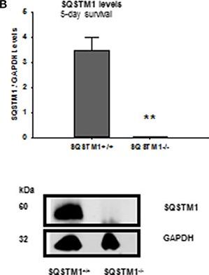 Sequestosome 1 Deficiency Delays, but Does Not Prevent Brain Damage Formation Following Acute Brain Injury in Adult Mice.