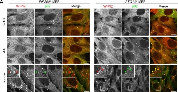 Hyperosmotic Stress Induces Unconventional Autophagy Independent of the Ulk1 Complex.