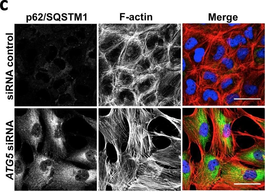 Autophagy inhibition-mediated epithelial-mesenchymal transition augments local myofibroblast differentiation in pulmonary fibrosis.