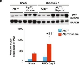 Autophagy attenuates tubulointerstital fibrosis through regulating transforming growth factor-β and NLRP3 inflammasome signaling pathway.