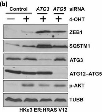 Autophagy inhibition specifically promotes epithelial-mesenchymal transition and invasion in RAS-mutated cancer cells.