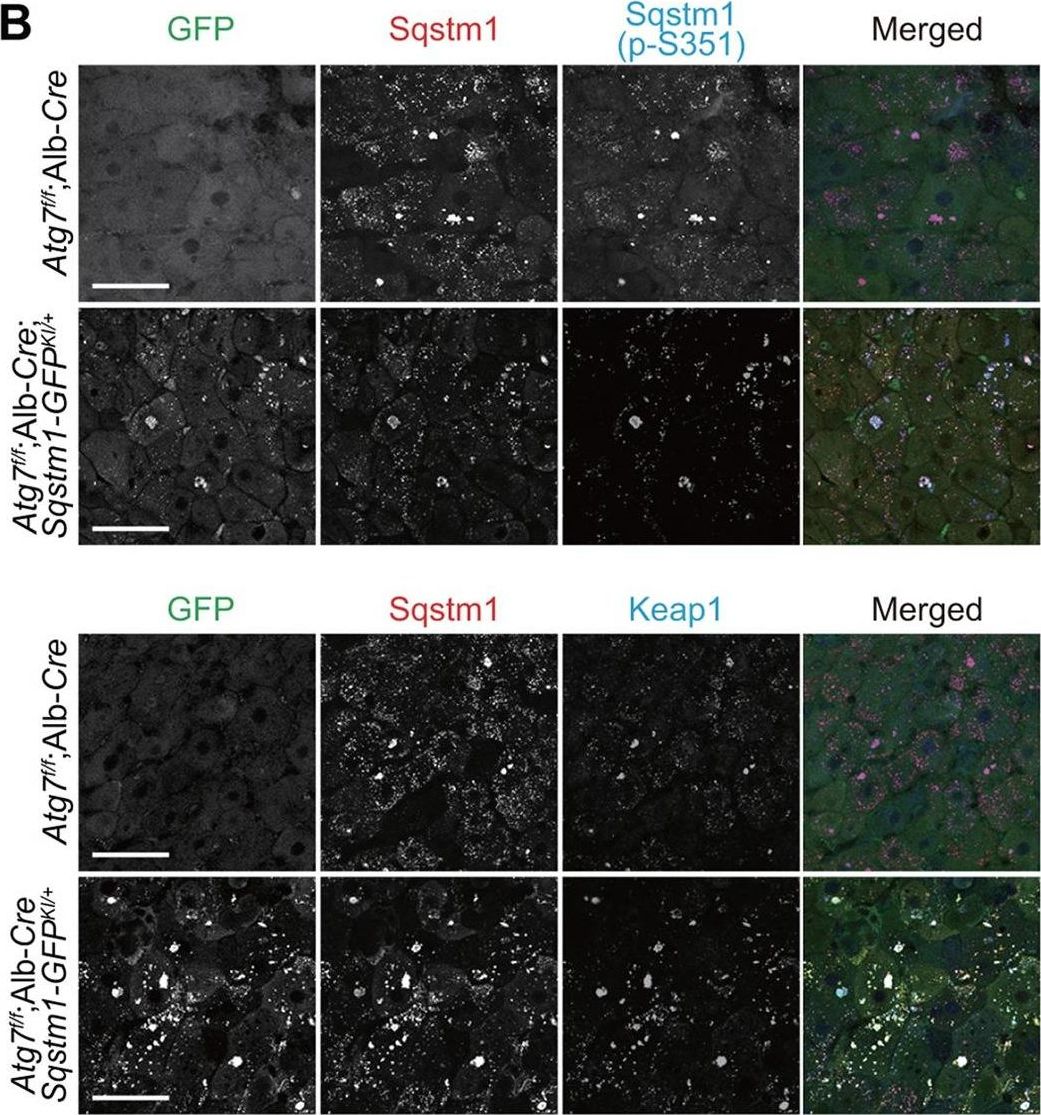 Sqstm1-GFP knock-in mice reveal dynamic actions of Sqstm1 during autophagy and under stress conditions in living cells.
