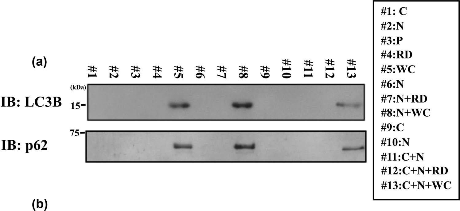 Degradation of connexin 50 protein causes waterclefts in human lens.