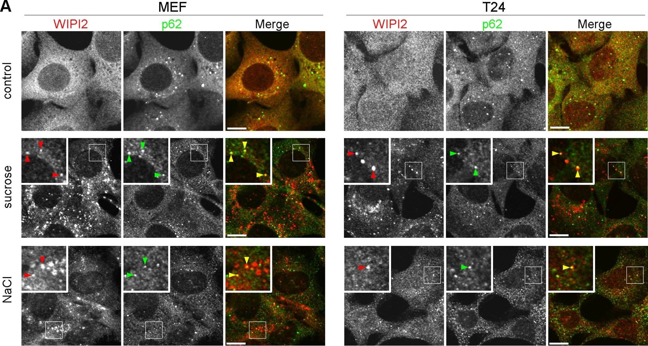 Hyperosmotic Stress Induces Unconventional Autophagy Independent of the Ulk1 Complex.