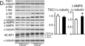 mTOR Hyperactivation by Ablation of Tuberous Sclerosis Complex 2 in the Mouse Heart Induces Cardiac Dysfunction with the Increased Number of Small Mitochondria Mediated through the Down-Regulation of Autophagy.