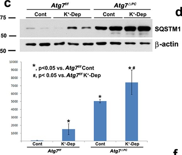 Atg7-dependent canonical autophagy regulates the degradation of aquaporin 2 in prolonged hypokalemia.