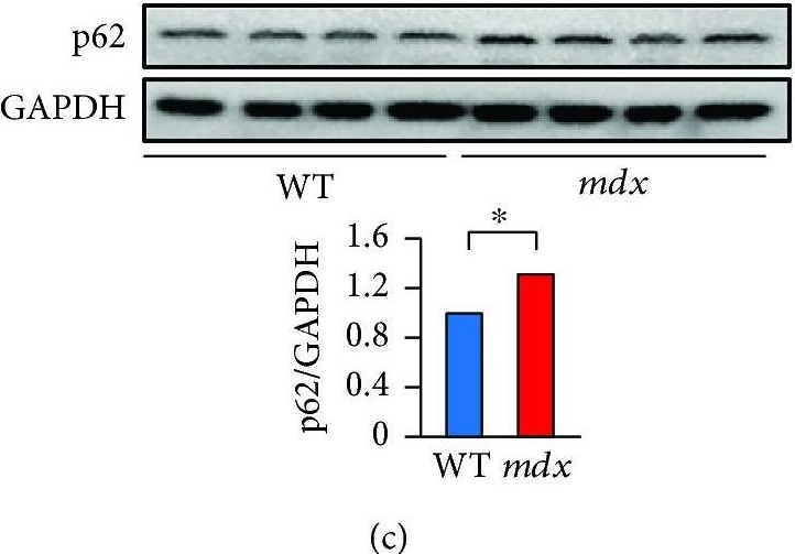 Resveratrol Decreases Oxidative Stress by Restoring Mitophagy and Improves the Pathophysiology of Dystrophin-Deficient mdx Mice.