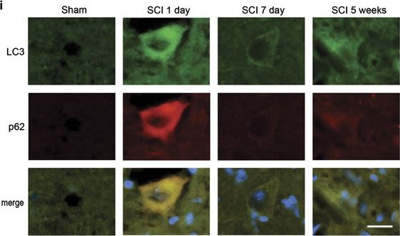 Disrupted autophagy after spinal cord injury is associated with ER stress and neuronal cell death.