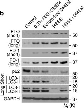 m6A mRNA demethylase FTO regulates melanoma tumorigenicity and response to anti-PD-1 blockade.