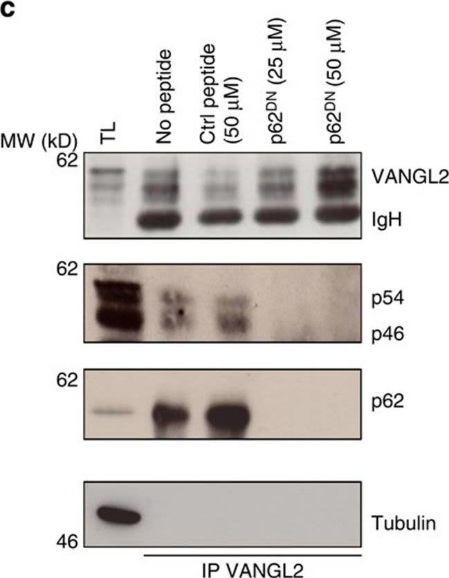 Identification of p62/SQSTM1 as a component of non-canonical Wnt VANGL2-JNK signalling in breast cancer.