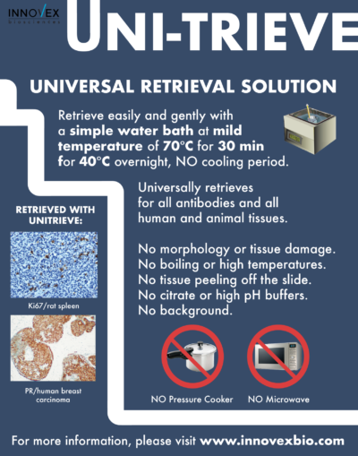 UNI-TRIEVE; Ready-To-Use - Image 2
