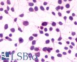 CNR1 / CB1 Antibody - Anti-CNR1 / CB1 antibody immunocytochemistry (ICC) staining of untransfected HEK293 human embryonic kidney cells.