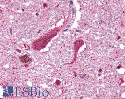 CNR1 / CB1 Antibody - Brain, substantia nigra