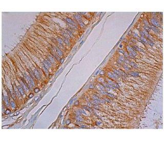 beta Tubulin Antibody (2-28-33) - Immunohistochemistry - Image 348746