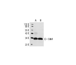 Cdk4 Antibody (DCS-31) - Western Blotting - Image 14608 