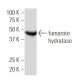 fumarate hydratase Antibody (J-13) - Western Blotting - Image 34117
