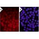 siRNA Transfection Reagent: sc-29528. Immuno-fluorescence staining of methanol-fixed HeLa cells...