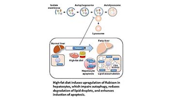 White Paper: Role of the autophagy regulator Rubicon in the pathogenesis of fatty liver disease.