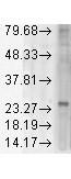 KDEL Western Blot