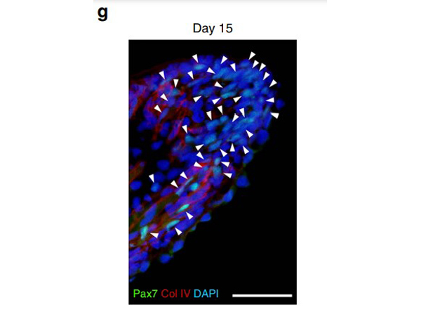 Immunohistochemistry of Anti-Collagen Type IV Antibody Biotin Conjugated